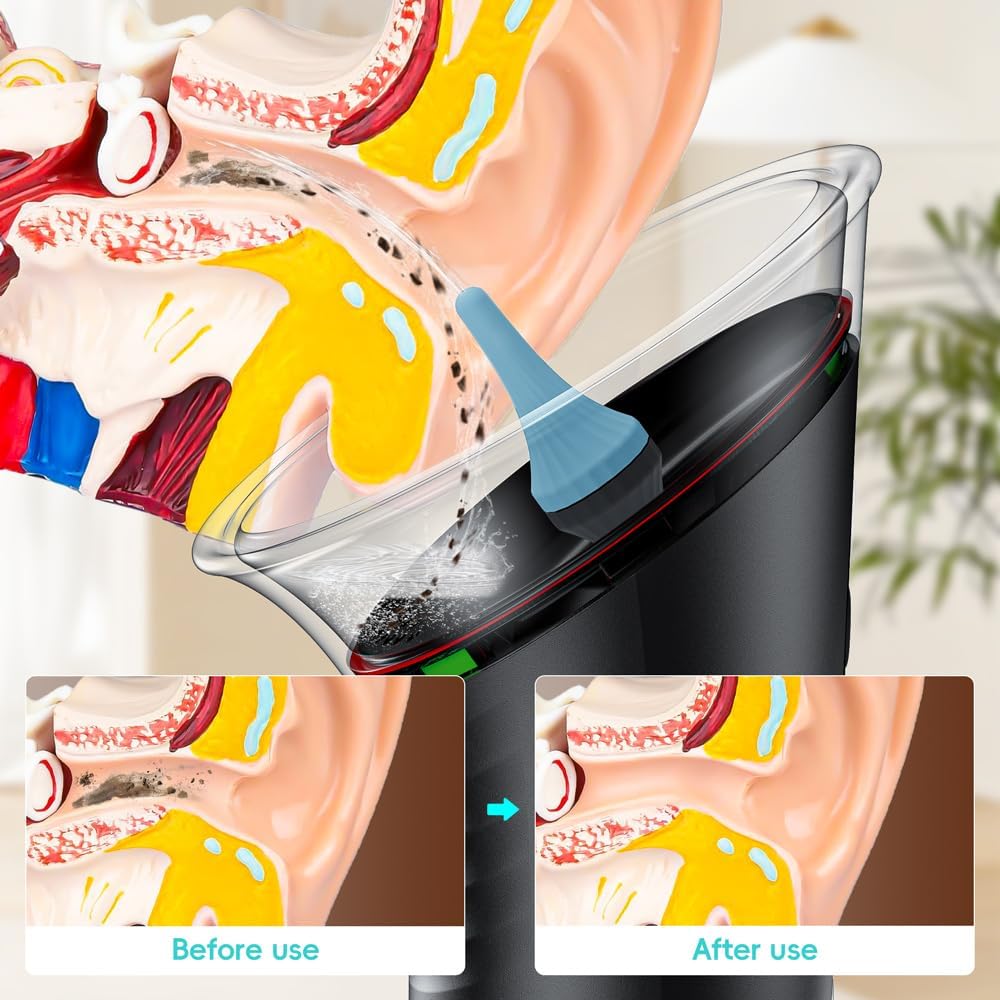 AuriFresh Ear Cleaner - close up